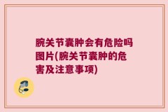腕关节囊肿会有危险吗图片(腕关节囊肿的危害及注意事项)