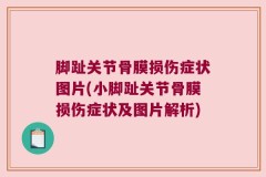 脚趾关节骨膜损伤症状图片(小脚趾关节骨膜损伤症状及图片解析)