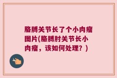 胳膊关节长了个小肉瘤图片(胳膊肘关节长小肉瘤，该如何处理？)