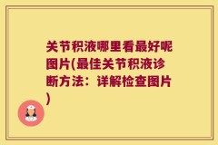 关节积液哪里看最好呢图片(最佳关节积液诊断方法：详解检查图片)