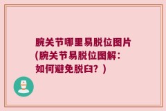 腕关节哪里易脱位图片(腕关节易脱位图解：如何避免脱臼？)