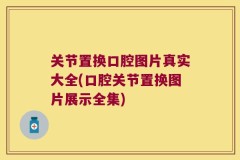 关节置换口腔图片真实大全(口腔关节置换图片展示全集)