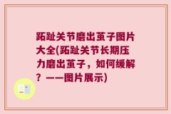 跖趾关节磨出茧子图片大全(跖趾关节长期压力磨出茧子，如何缓解？——图片展示)