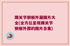 踝关节钢板外漏图片大全(全方位呈现踝关节钢板外露的图片合集)