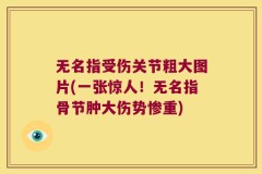 无名指受伤关节粗大图片(一张惊人！无名指骨节肿大伤势惨重)