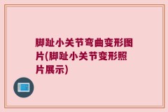 脚趾小关节弯曲变形图片(脚趾小关节变形照片展示)