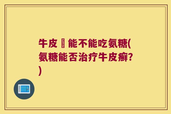 牛皮癬能不能吃氨糖(氨糖能否牛皮癣？)