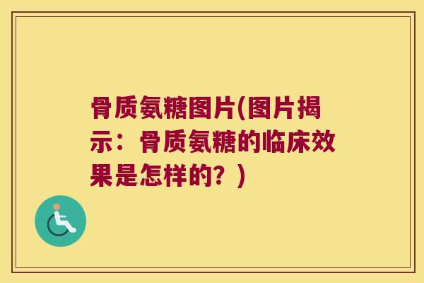 骨质氨糖图片(图片揭示:骨质氨糖的临床效果是怎样的?) 骨质氨糖图片(图片揭示:骨质氨糖的临床效果是怎样的?)