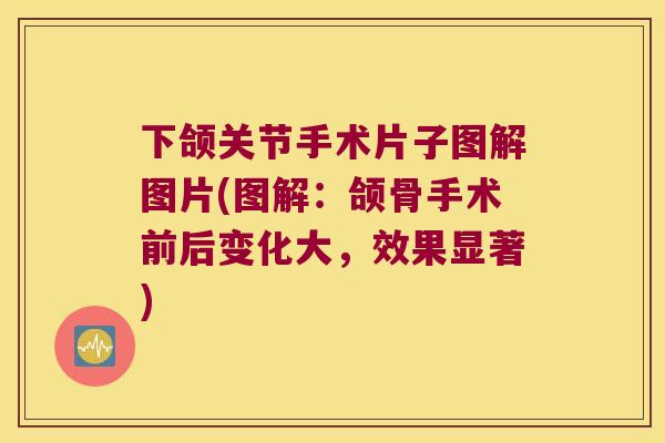 下颌关节手术片子图解图片(图解:颌骨手术前后变化大,效果显著) 下颌关节手术片子图解图片(图解:颌骨手术前后变化大,效果显著)