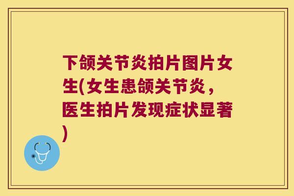 下颌拍片图片女生(女生患颌,医生拍片发现症状显著) 下颌拍片图片女生(女生患颌,医生拍片发现症状显著)