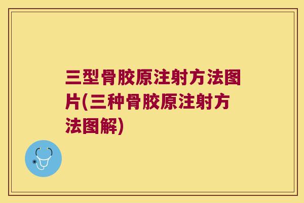 三型骨胶原注射方法图片(三种骨胶原注射方法图解) 三型骨胶原注射方法图片(三种骨胶原注射方法图解)