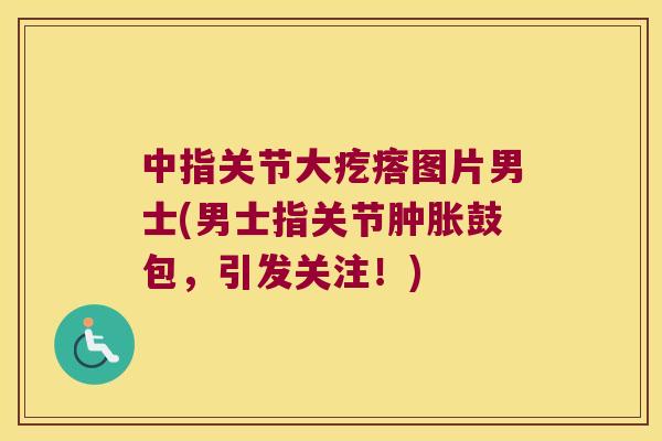 中指关节大疙瘩图片男士(男士指关节鼓包，引发关注！)