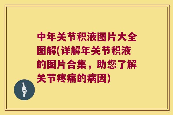 中年关节积液图片大全图解(详解年关节积液的图片合集,助您了解关节的因) 中年关节积液图片大全图解(详解年关节积液的图片合集,助您了解关节的因)