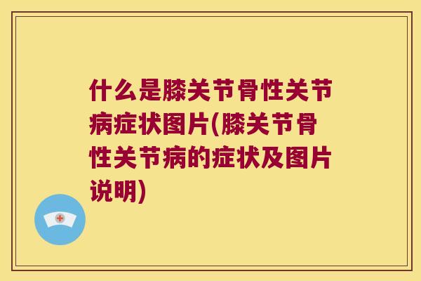 什么是膝关节骨性关节症状图片(膝关节骨性关节的症状及图片说明) 什么是膝关节骨性关节症状图片(膝关节骨性关节的症状及图片说明)