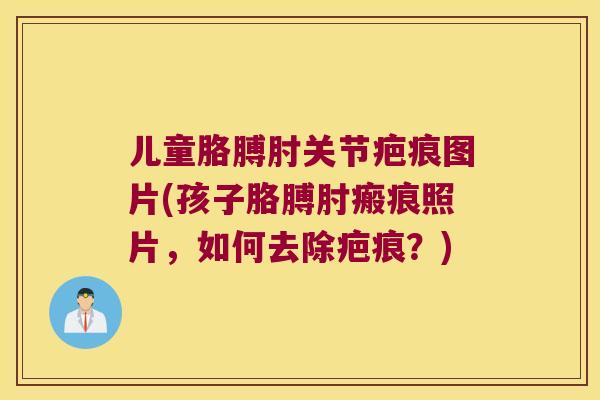 儿童胳膊肘关节疤痕图片(孩子胳膊肘瘢痕照片,如何去除疤痕?) 儿童胳膊肘关节疤痕图片(孩子胳膊肘瘢痕照片,如何去除疤痕?)