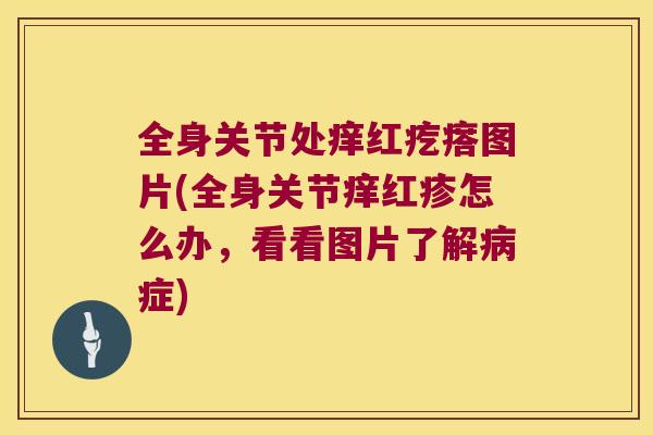 全身关节处痒红疙瘩图片(全身关节痒红疹怎么办，看看图片了解症)