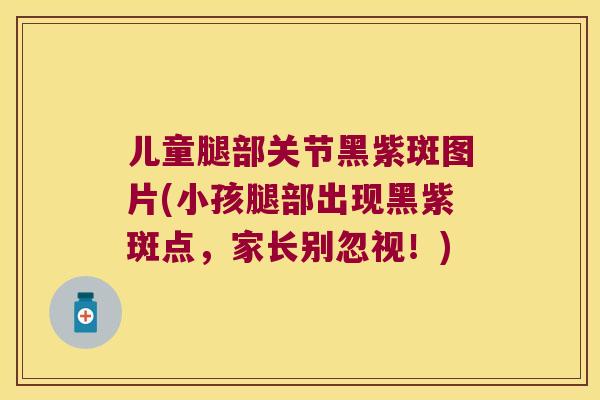 儿童腿部关节黑紫斑图片(小孩腿部出现黑紫斑点,家长别忽视!) 儿童腿部关节黑紫斑图片(小孩腿部出现黑紫斑点,家长别忽视!)