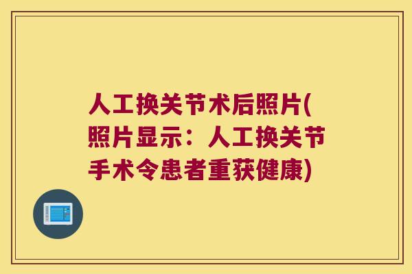 人工换关节术后照片(照片显示：人工换关节手术令患者重获健康)
