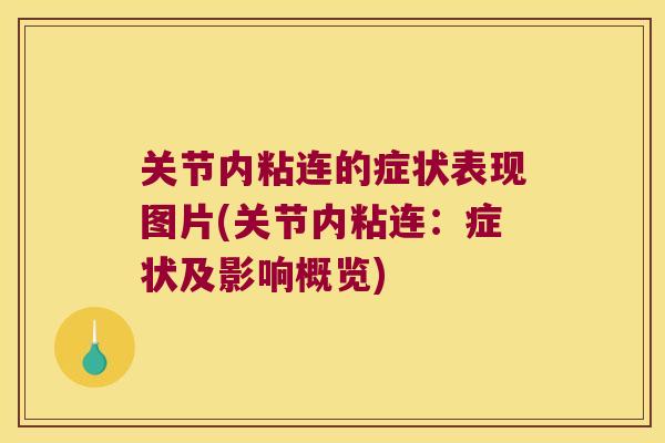 关节内粘连的症状表现图片(关节内粘连:症状及影响概览) 关节内粘连的症状表现图片(关节内粘连:症状及影响概览)