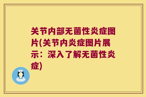 关节内部无菌性图片(关节内图片展示:深入了解无菌性) 关节内部无菌性图片(关节内图片展示:深入了解无菌性)