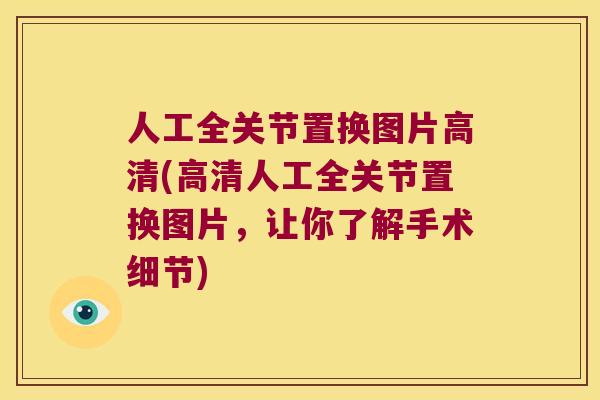 人工全关节置换图片高清(高清人工全关节置换图片，让你了解手术细节)