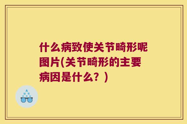 什么致使关节畸形呢图片(关节畸形的主要因是什么？)