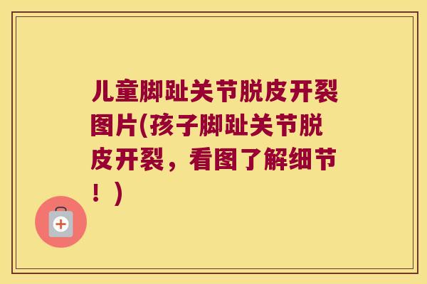 儿童脚趾关节脱皮开裂图片(孩子脚趾关节脱皮开裂，看图了解细节！)