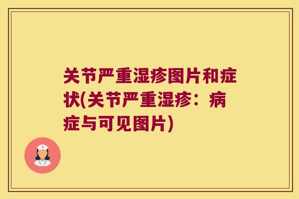关节严重图片和症状(关节严重：症与可见图片)