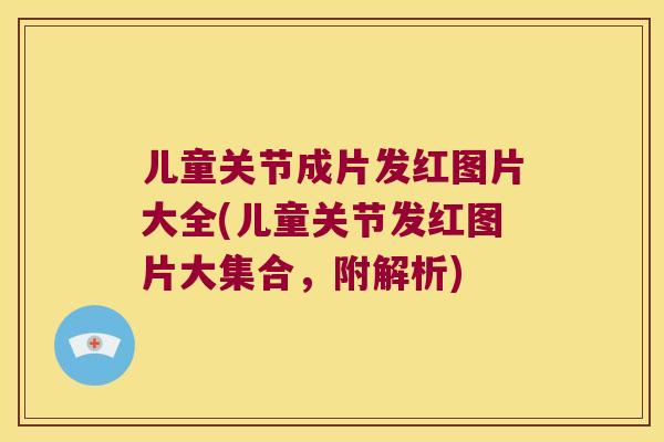 儿童关节成片发红图片大全(儿童关节发红图片大集合,附解析) 儿童关节成片发红图片大全(儿童关节发红图片大集合,附解析)