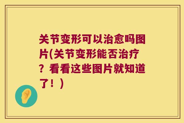 关节变形可以愈吗图片(关节变形能否？看看这些图片就知道了！)