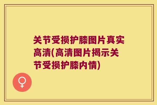 关节受损护膝图片真实高清(高清图片揭示关节受损护膝内情) 关节受损护膝图片真实高清(高清图片揭示关节受损护膝内情)