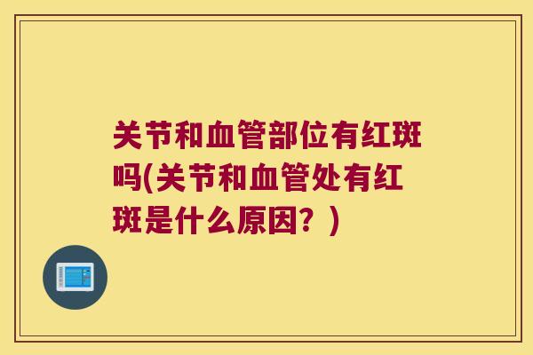 关节和部位有红斑吗(关节和处有红斑是什么原因?) 关节和部位有红斑吗(关节和处有红斑是什么原因?)