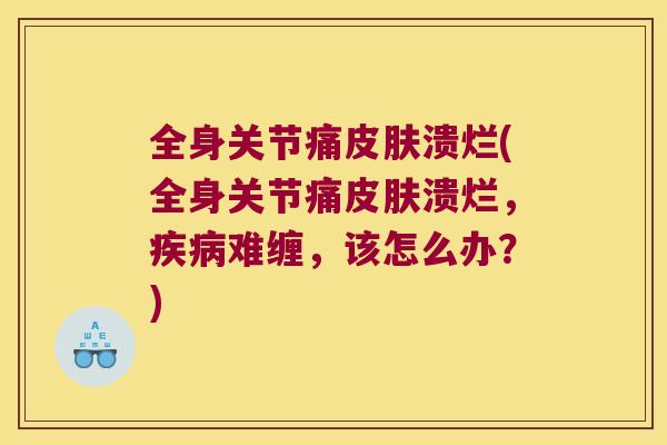 全身关节痛溃烂(全身关节痛溃烂,难缠,该怎么办?) 全身关节痛溃烂(全身关节痛溃烂,难缠,该怎么办?)