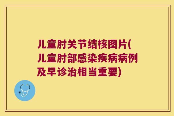儿童肘关节结核图片(儿童肘部例及早诊相当重要)