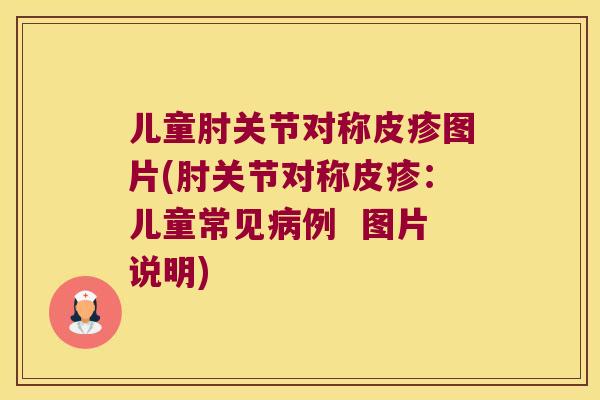 儿童肘关节对称皮疹图片(肘关节对称皮疹:儿童常见例 图片说明) 儿童肘关节对称皮疹图片(肘关节对称皮疹:儿童常见例 图片说明)