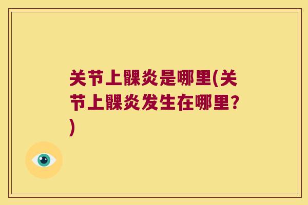 关节上髁炎是哪里(关节上髁炎发生在哪里?) 关节上髁炎是哪里(关节上髁炎发生在哪里?)