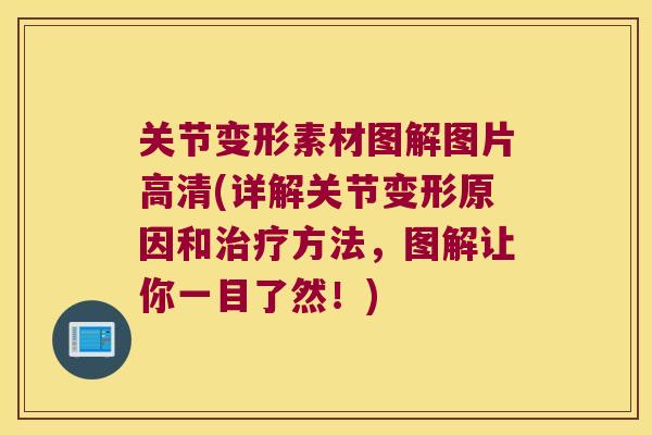 关节变形素材图解图片高清(详解关节变形原因和方法,图解让你一目了然!) 关节变形素材图解图片高清(详解关节变形原因和方法,图解让你一目了然!)