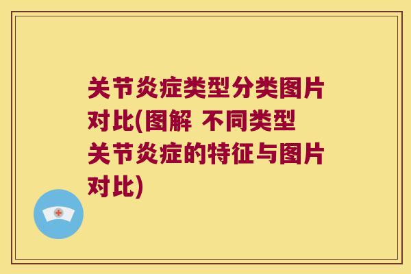 关节类型分类图片对比(图解 不同类型关节的特征与图片对比)
