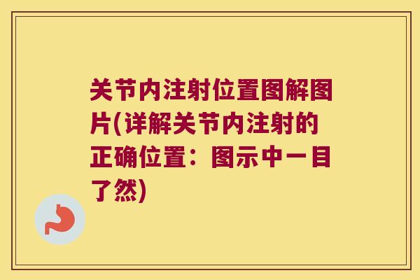 关节内注射位置图解图片(详解关节内注射的正确位置：图示中一目了然)