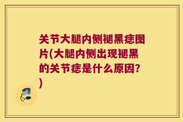 关节大腿内侧褪黑痣图片(大腿内侧出现褪黑的关节痣是什么原因?) 关节大腿内侧褪黑痣图片(大腿内侧出现褪黑的关节痣是什么原因?)