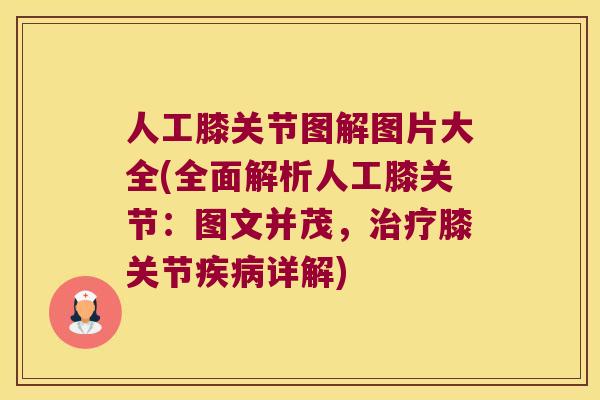 人工膝关节图解图片大全(全面解析人工膝关节:图文并茂,膝关节详解) 人工膝关节图解图片大全(全面解析人工膝关节:图文并茂,膝关节详解)