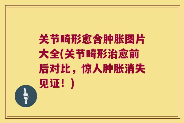 关节畸形愈合图片大全(关节畸形愈前后对比,惊人消失见证!) 关节畸形愈合图片大全(关节畸形愈前后对比,惊人消失见证!)