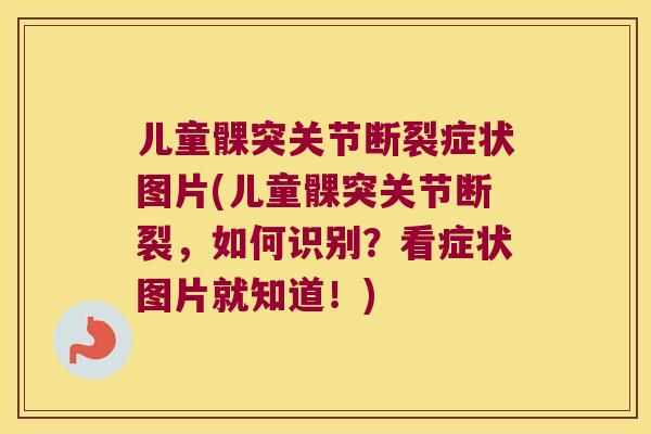 儿童髁突关节断裂症状图片(儿童髁突关节断裂，如何识别？看症状图片就知道！)