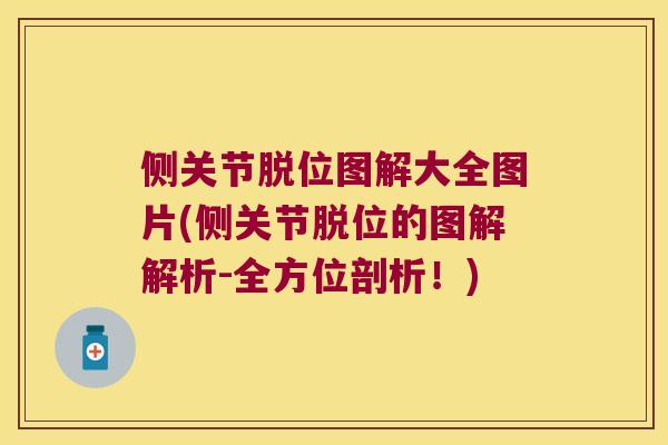 侧关节脱位图解大全图片(侧关节脱位的图解解析-全方位剖析！)