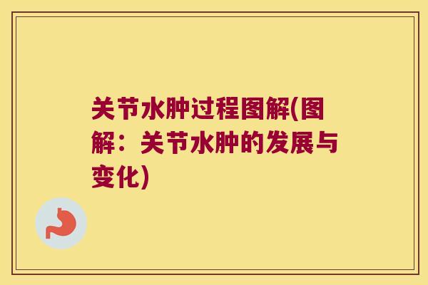 关节水肿过程图解(图解:关节水肿的发展与变化) 关节水肿过程图解(图解:关节水肿的发展与变化)
