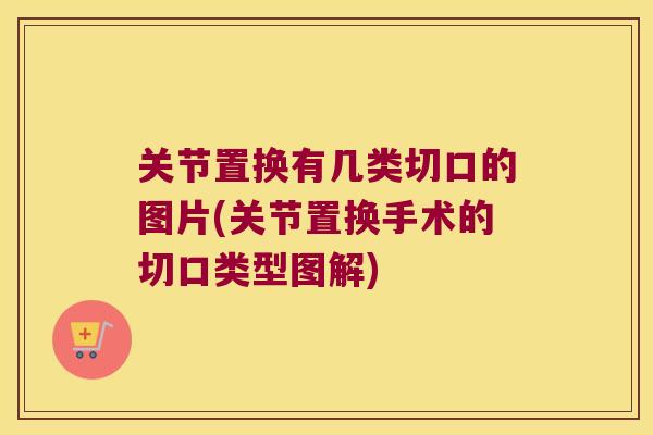关节置换有几类切口的图片(关节置换手术的切口类型图解) 关节置换有几类切口的图片(关节置换手术的切口类型图解)