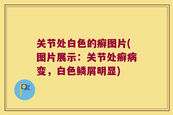关节处白色的癣图片(图片展示：关节处癣变，白色鳞屑明显)