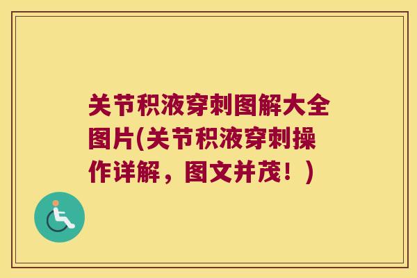 关节积液穿刺图解大全图片(关节积液穿刺操作详解,图文并茂!) 关节积液穿刺图解大全图片(关节积液穿刺操作详解,图文并茂!)