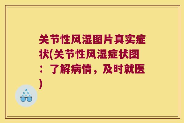 关节性图片真实症状(关节性症状图:了解情,及时就医) 关节性图片真实症状(关节性症状图:了解情,及时就医)