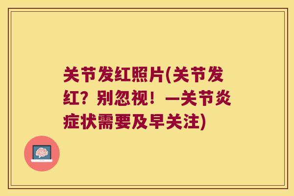 关节发红照片(关节发红?别忽视!—关节状需要及早关注) 关节发红照片(关节发红?别忽视!—关节状需要及早关注)
